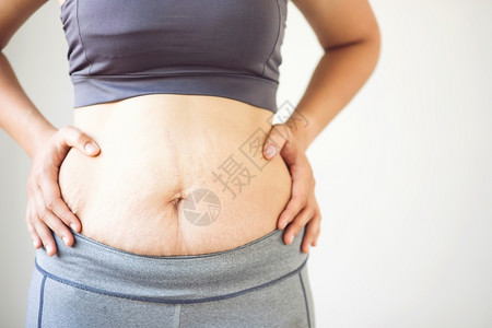 重量经常成人肥胖妇女通过控制体重和定期锻炼正在减负体重图片