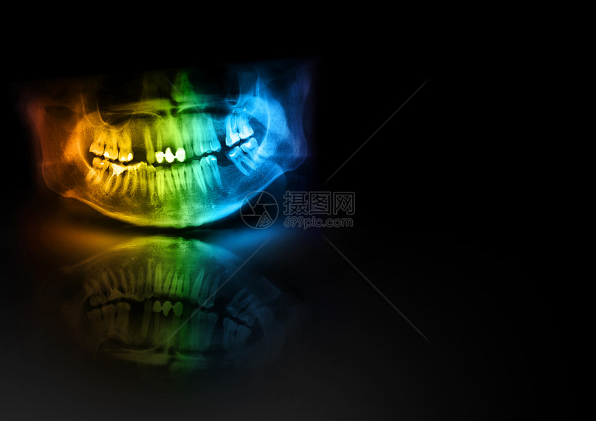 全景射线照片是上颌骨和下黑色背景的扫描牙科X射线具有发光阴影和反射的医学水平设计文本模板医疗的射线照相辉光图片