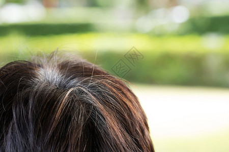 金发女郎染色年轻人的后视镜早发灰色头显示黑毛巾根在部改变后长成大老人户外棕色的图片