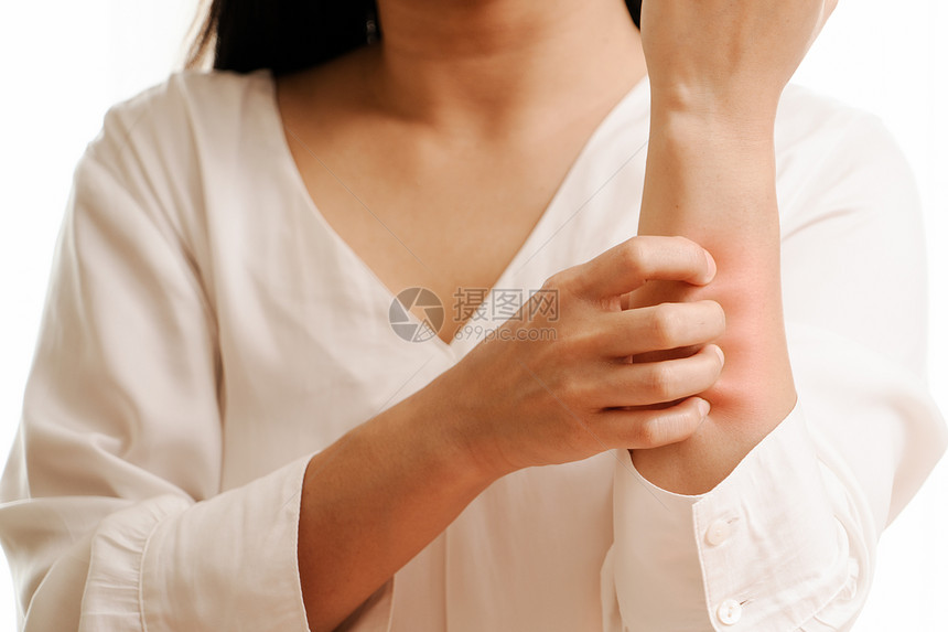 妇女的手在臂保健和医药概念上划痒发癣蚊子图片