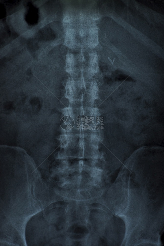 蓝色的X射线脊椎柱生物学男图片
