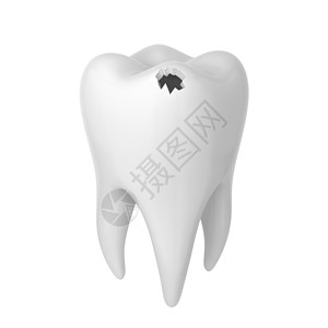 嘴关心恢复白背景上孤立的牙洞3D插图图片
