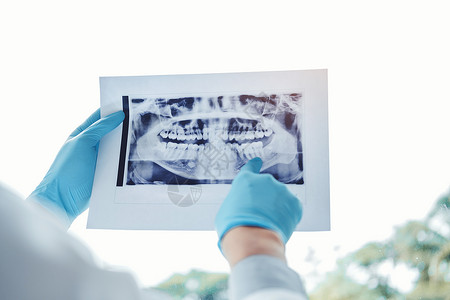 看X光片的牙医图片