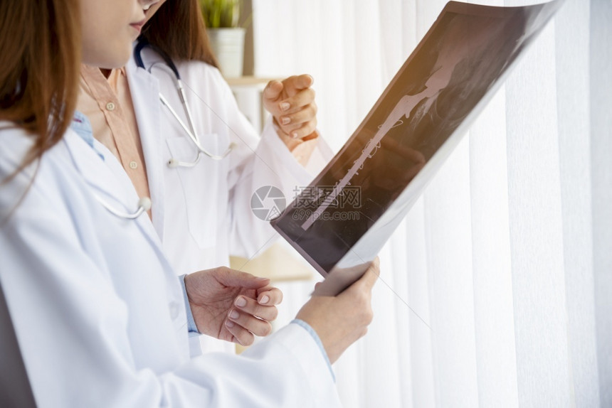 两名女医生讨论X光片图片