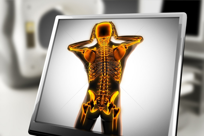 X射线扫描人体图像图片