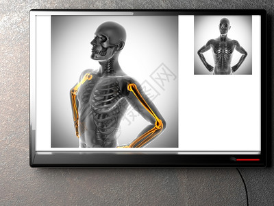 X射线扫描人体图像图片