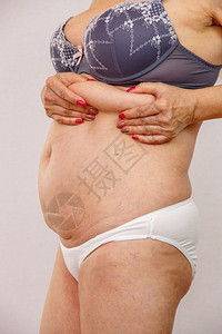 肥胖的老年妇女图片