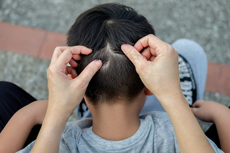 洗发水母亲在抓头找虱子和治疗孩的毛发男坐着图片