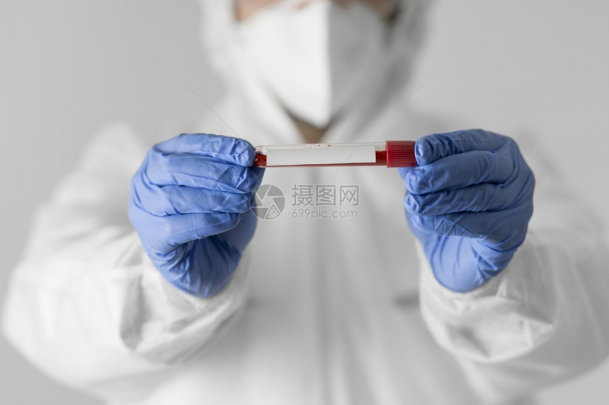 生物化学管子红色的负责验血特闭医生图片