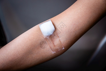 采集血液后用棉花贴伤口的病人图片