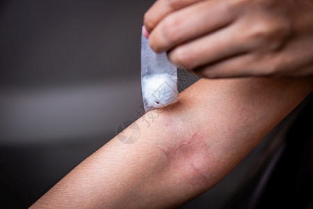 在采集血液后用棉花贴伤口背景图片