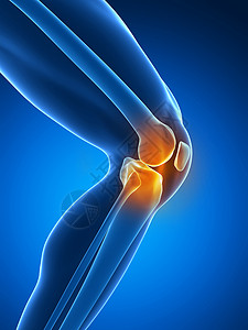 运动慢跑者3d膝部疼痛蓝色颜跑步设计图片