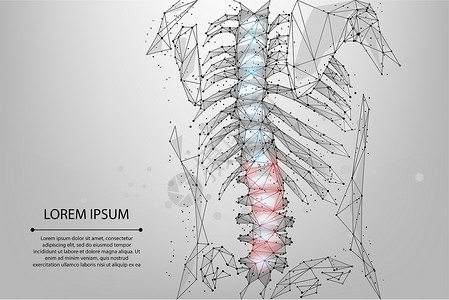 脐疝解剖学诊所X射线抽象网状和圆形理物疗法人类脊椎多边形使雌后背产生hernia设计图片