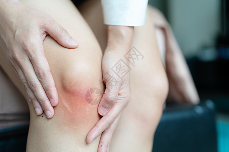 磨损流血的治疗Asiia妇女膝盖受青伤有选择地集中背景图片