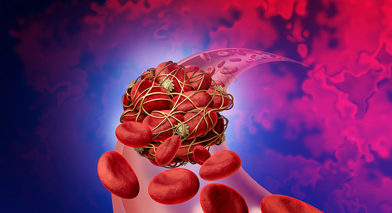 纤维蛋白解剖学血液凝或栓健康风险病医学说明概念符号作为一组人类血细胞被粘黏的小板挤在一起纤维素作为3D制成的动脉或血管堵塞剂和纤维素作为设计图片