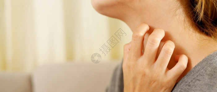 生病的由于COVID19妇女患有痒皮肤刺激的病热瓜拉纳皮图片