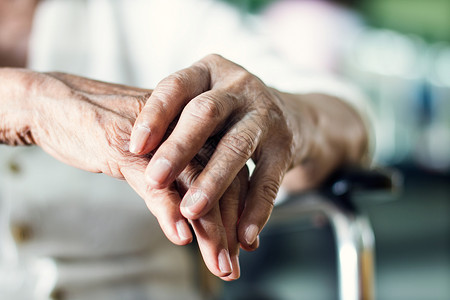病人患有帕金森症状的老年女患者的近手心理健康与老年护念震颤老的图片