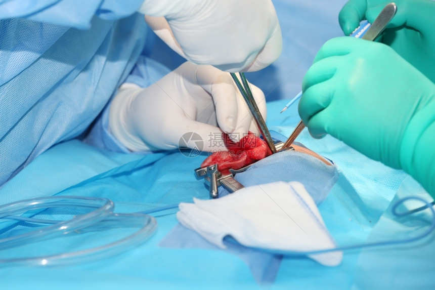 夹钳补给品乐器手术室4个月大男孩肺气肿手术图片