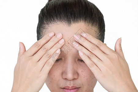 去除雀斑温泉按摩化妆品亚洲妇女激光治疗的面部和颈激光处理器皮肤雀斑和黑暗点产生的烧或沙巴背景