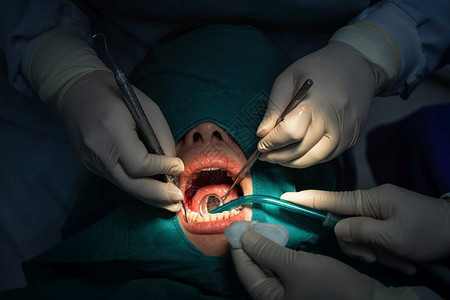 在牙科诊所进行手术治疗的病人图片