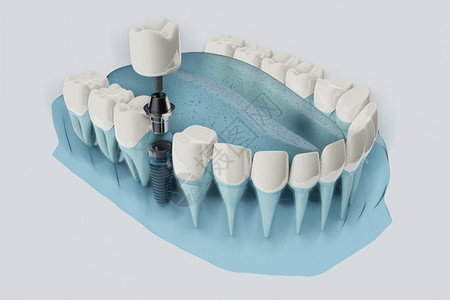 牙齿颜色药物蓝色透明3D插图颜色透明3d插图半透明修理设计图片