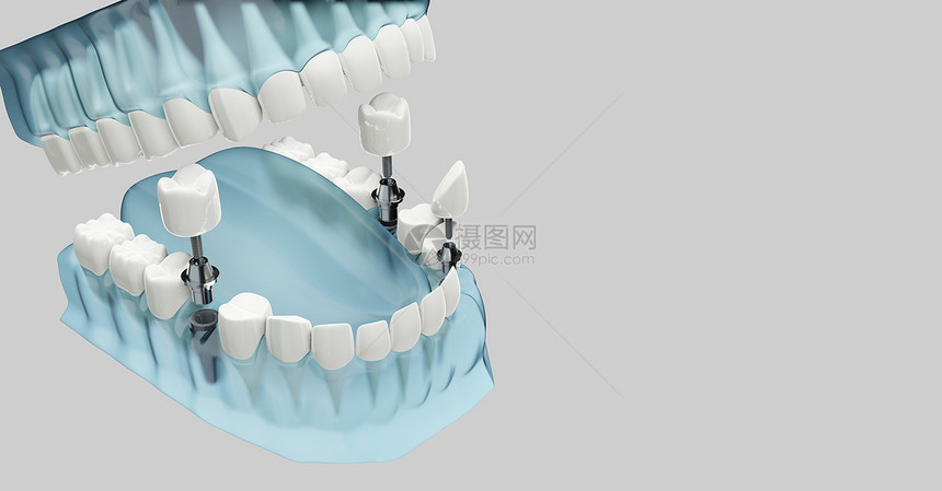 蓝色透明3D插图颜色透明3d插图嘴橹牙齿图片