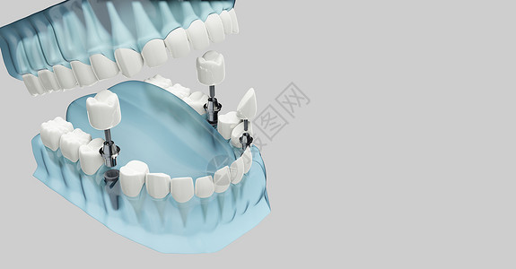 牙齿颜色蓝色透明3D插图颜色透明3d插图嘴橹牙齿设计图片