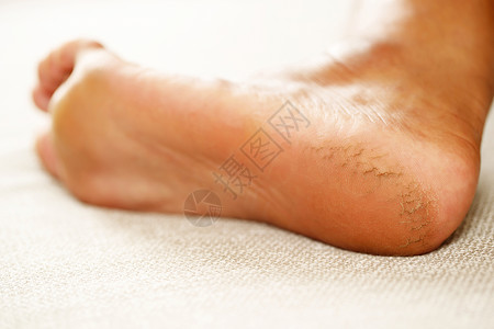 透皮吸收脚霜应定期施用按摩高跟鞋使奶油吸收水井帮助将分添加到脚皮上b提高水分腿应用干燥背景