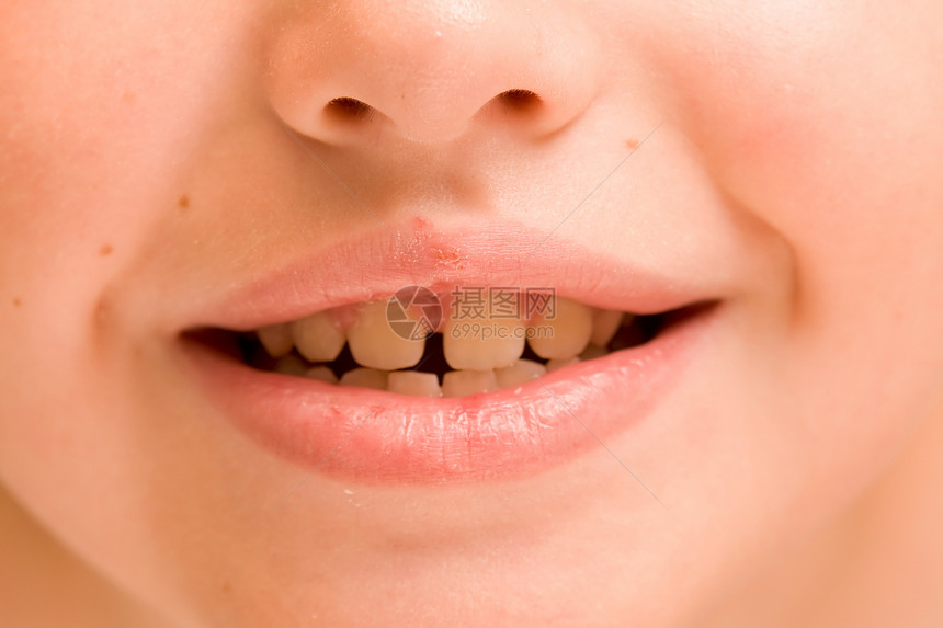 微笑快乐白色牙科牙齿喜悦幸福孩子童年图片