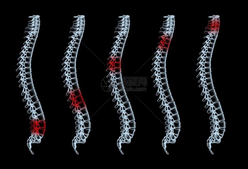 x射线放射科骨干生物学身体x光解剖学骨骼医疗病人脊椎动物图片