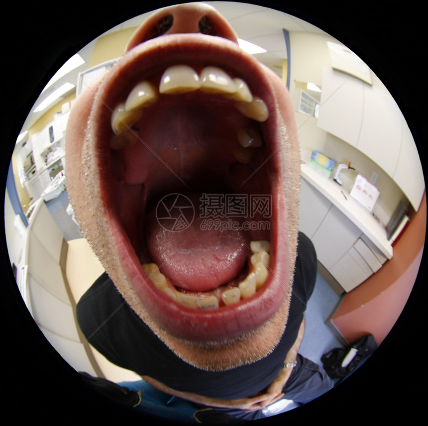 在牙医临床疾病男人愈合插图牙齿舌头漫画噪音医生图片
