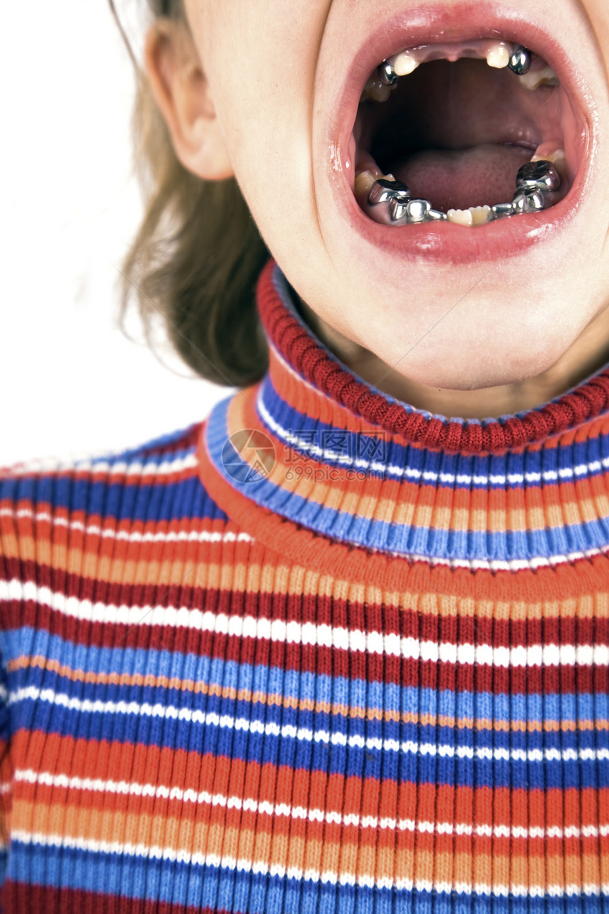 有牙齿问题的女孩舌头出牙期假牙牙科童年图片