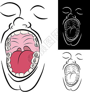 恢复性的装有金属牙科填充材料的嘴唇插画