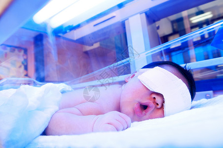 紫外光线下新生儿治疗婴儿期医疗保健黄疸疗法光疗新生婴儿童年背景图片