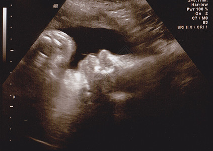 胎儿医疗声波图背景图片