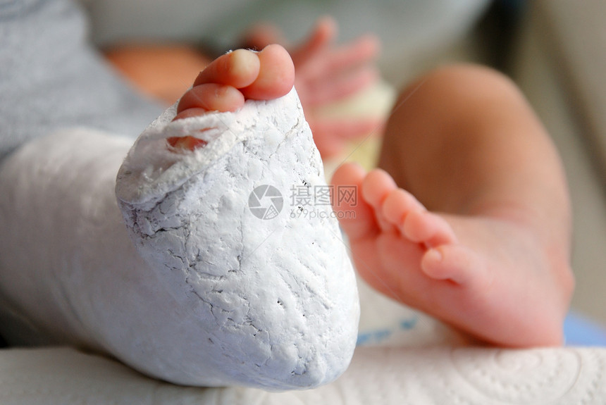 在绷带和石膏中婴儿脚男生卫生水平医疗骨科保健照片夹板图片