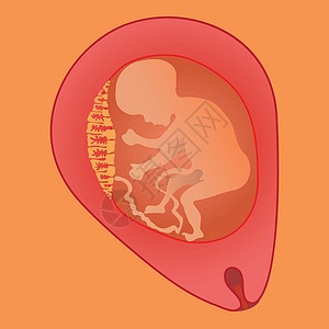 前置胎盘胎儿医疗插图脐带生长生理生育力流产女士子宫婴儿插画