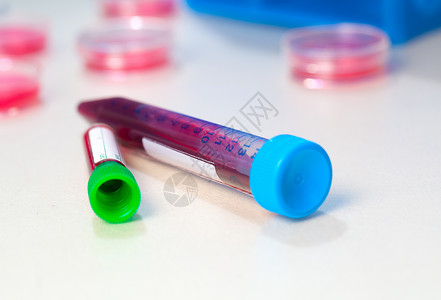 血液管中用于实验室分析生物学酶联器皿物质测试微生物学遗传学试管科学液体背景图片