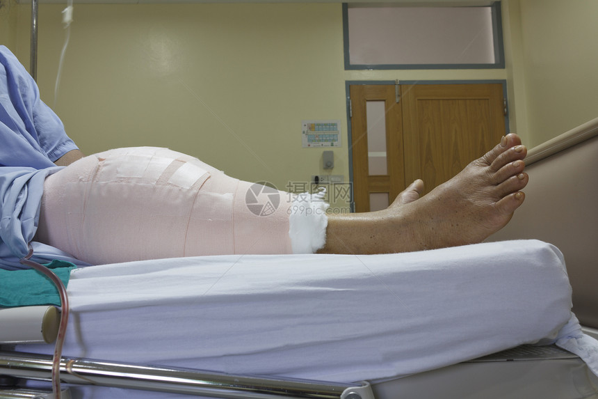 替代膝盖的切口女性瘢痕外科设备疼痛病房骨科残疾人保健疾病图片