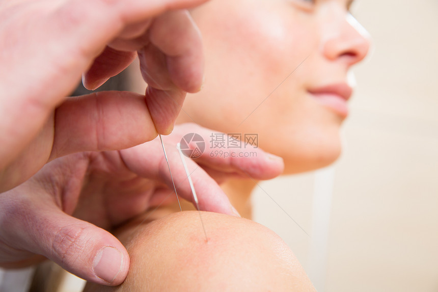 医生亲手针缝针针刺女人药品愈合肩膀福利治疗师女孩治疗女性温泉针灸师图片