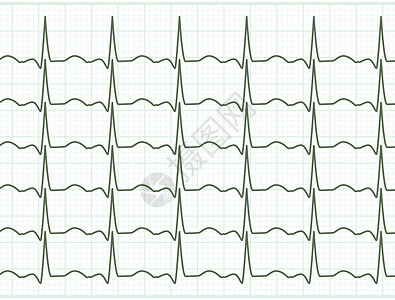 EPS 8心脏心血管病医院药品疾病诊断插图脉动收藏心电图监控痕迹背景图片