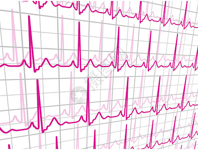 卡通心电监护仪心脏跳过心心动图 EPS 8设计图片