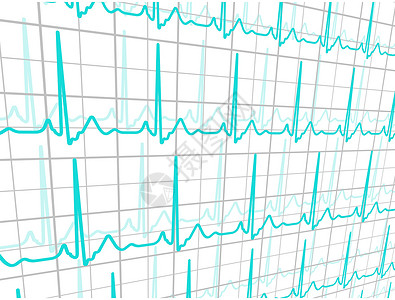 EPS 8心脏心血管病诊断科学药品健康心电图医院蓝色脉冲疾病医疗背景图片