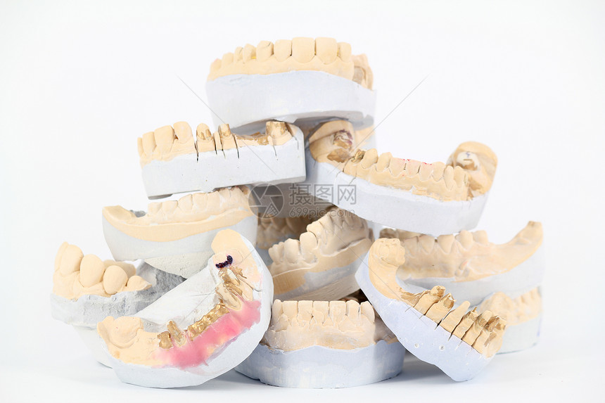 牙齿石膏模型假肢保健牙科假牙白色卫生下颌磨牙图片