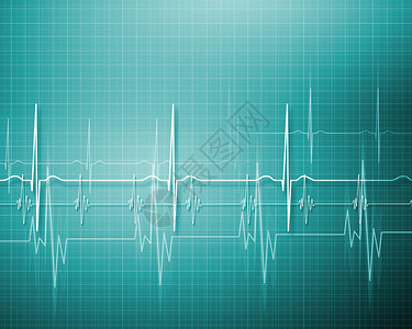 音速的音速图像压力卫生心电图药品曲线健康病人图表海浪网格背景