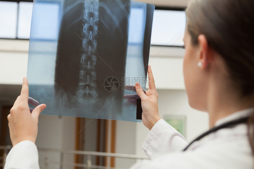 持有X光的女医生诊断工作服检查栏杆门厅通道阅读医院实验医疗图片