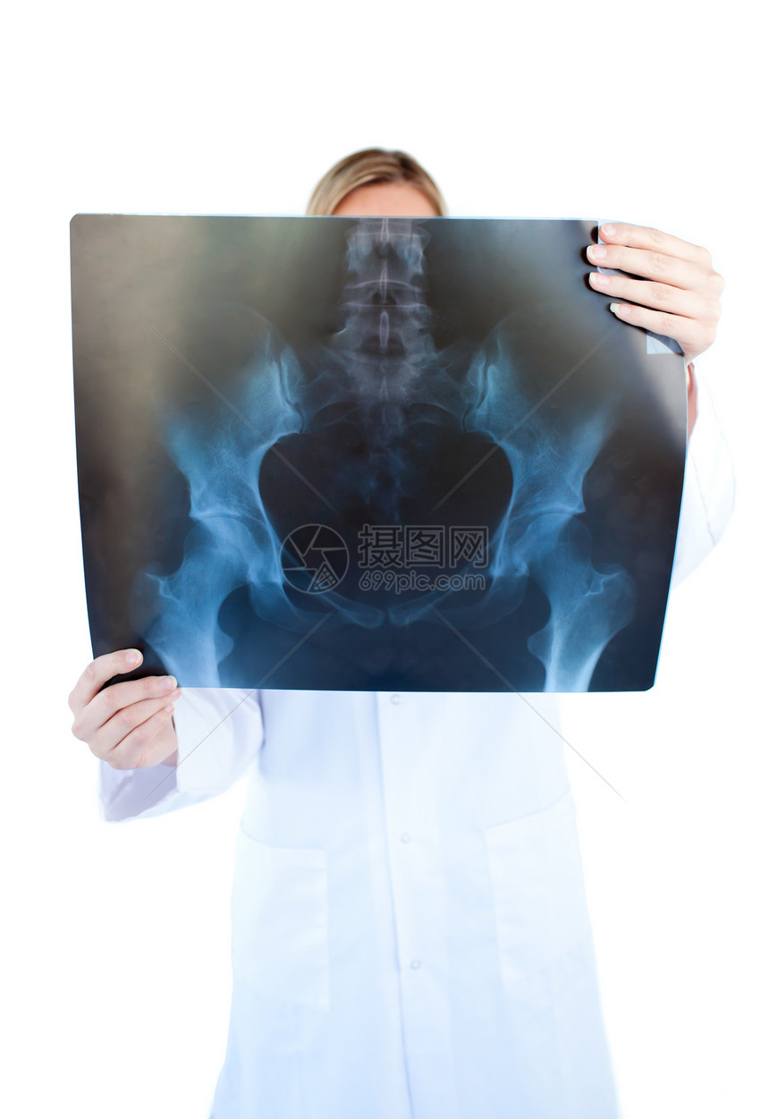 集中的女医生持有X光片图片