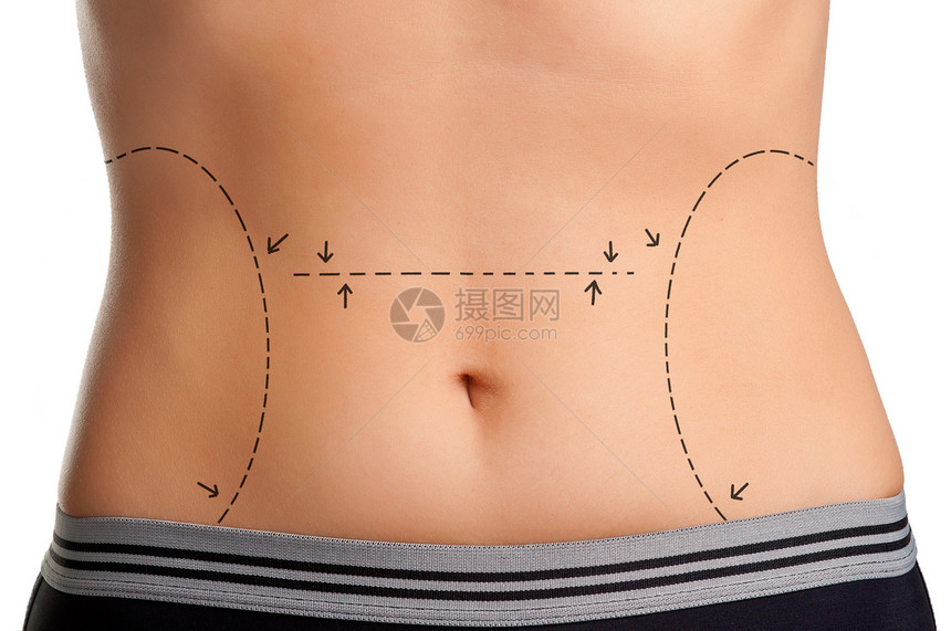 整型外科女士腰部肚子女孩医疗手术成人病人考试线条图片