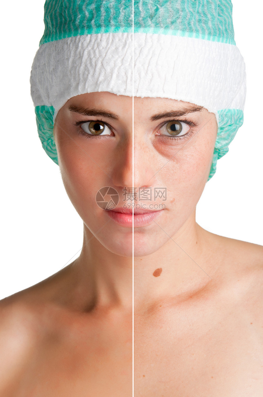 皮肤护理女性眼睛女士矫正青年手术诊所医院治疗外科图片