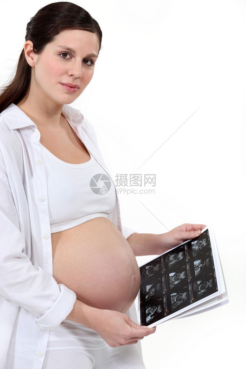 进行扫描的孕妇图片